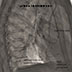 Lateral chest x-ray 2